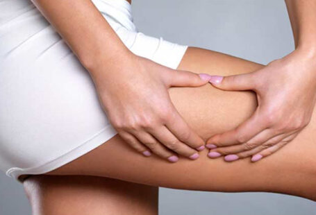 Striort Çatlak Tedavisi